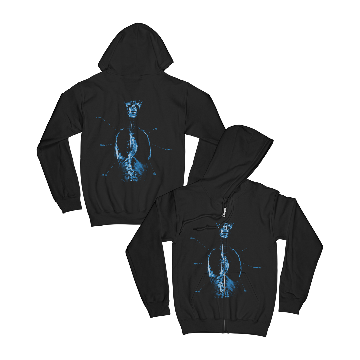 Scoliosis Hoodie